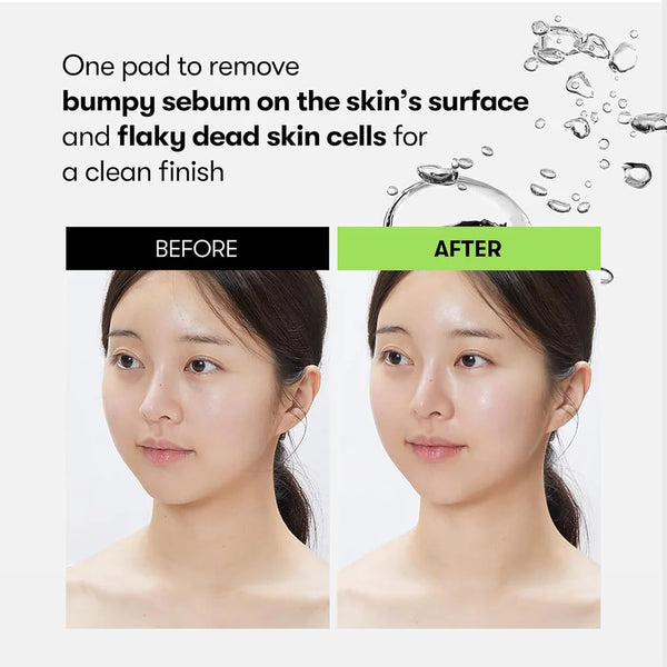 Ādu atjaunojoši spilventiņi ar gāzētu ūdeni VT Cosmetics Reedle Shot Synergy Sparkling Toner Pad