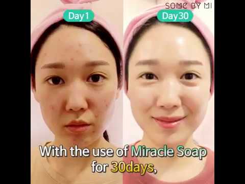 Attīrošas ziepes ar skābēm problemātiskai ādai Some By Mi AHA-BHA-PHA 30 Days Miracle Cleansing Bar